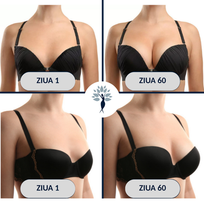 BUST'UP - PLASTURE PENTRU SÂNI