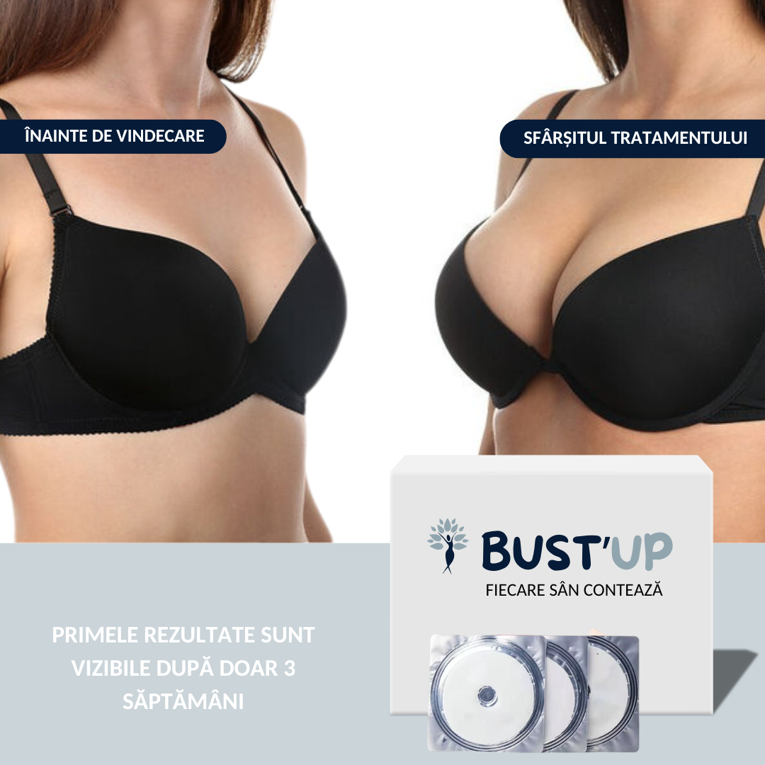 BUST'UP - PLASTURE PENTRU SÂNI